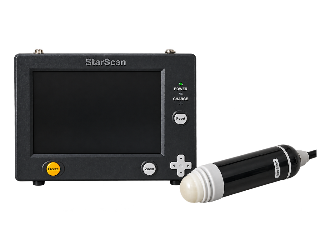Scanner SC100 - Ultralydsscanner